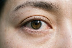 Gérer la sécheresse oculaire : symptômes, causes et solutions